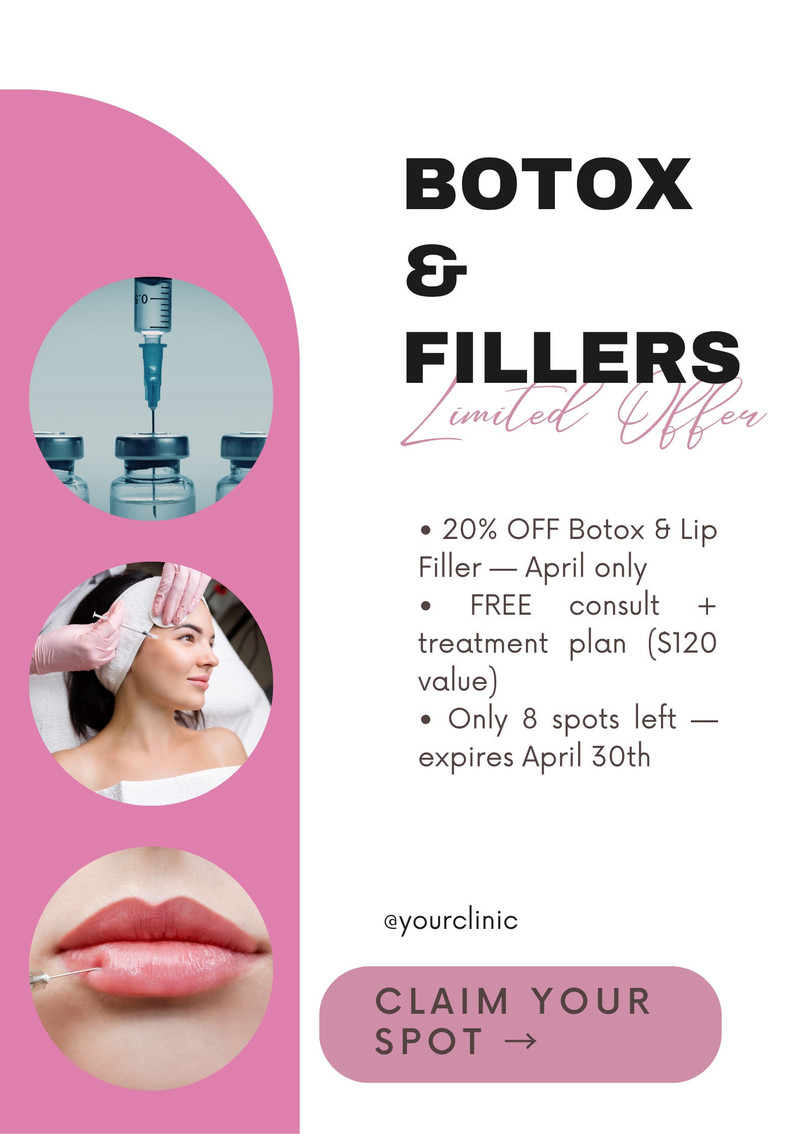 Newsletter dizajn za botox i fillere – promotivna kampanja, email marketing